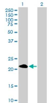 Western Blot: PAGE4 Antibody [H00009506-B01P]