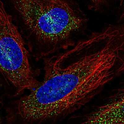 Immunocytochemistry/ Immunofluorescence: PAIP2 Antibody [NBP2-38802]