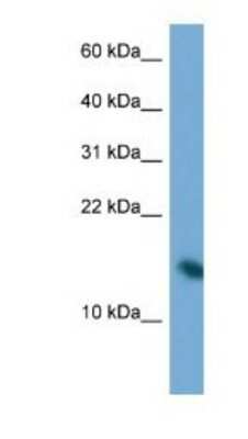Western Blot: PAIP2 Antibody [NBP1-79620]