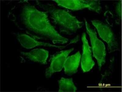Immunocytochemistry/ Immunofluorescence: PAK1 Antibody (4D1) [H00005058-M02]