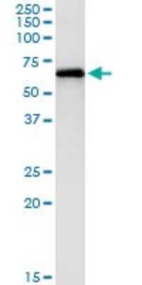 Immunoprecipitation: PAK1 Antibody (4D1) [H00005058-M02]