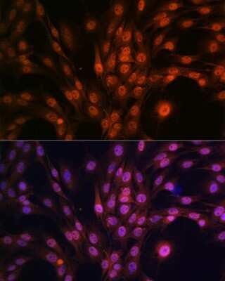 Immunocytochemistry/ Immunofluorescence: PAK2 Antibody (2Y7I2) [NBP3-16433]