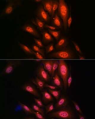 Immunocytochemistry/ Immunofluorescence: PAK2 Antibody (2Y7I2) [NBP3-16433]