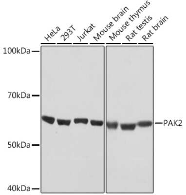 Western Blot: PAK2 Antibody (2Y7I2) [NBP3-16433]