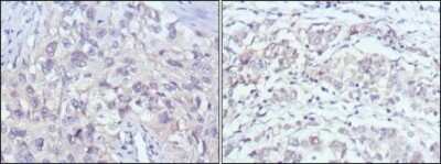 Immunohistochemistry-Paraffin: PAK2 Antibody (3B5) - BSA Free [NBP1-47542]