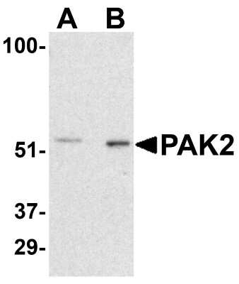 Western Blot: PAK2 AntibodyBSA Free [NBP1-76720]