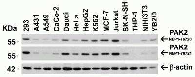 Western Blot: PAK2 AntibodyBSA Free [NBP1-76720]