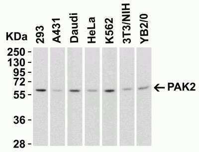 Western Blot: PAK2 AntibodyBSA Free [NBP1-76720]