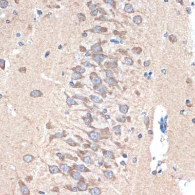 Immunohistochemistry-Paraffin: PAK3 Antibody (0K1I5) [NBP3-16173]