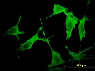 Immunocytochemistry/ Immunofluorescence: PAK3 Antibody (1H7) [H00005063-M07]
