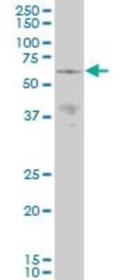 Western Blot: PAK3 Antibody (1H7) [H00005063-M07]