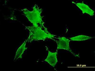 Immunocytochemistry/ Immunofluorescence: PAK3 Antibody (3A12) [H00005063-M08]