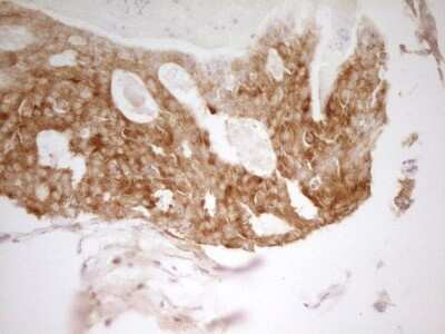 Immunohistochemistry: PAK4 Antibody (OTI1C7) [NBP2-46316]