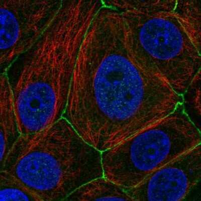 Immunocytochemistry/ Immunofluorescence: PAK4 Antibody [NBP2-56634]