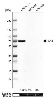Western Blot: PAK4 Antibody [NBP2-56634]