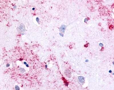 Immunohistochemistry-Paraffin: PAK6 Antibody - BSA Free [NLS6942]