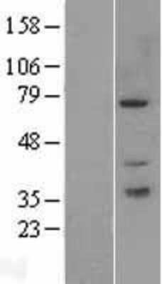 Western Blot: PAK6 Overexpression Lysate [NBP2-09484]