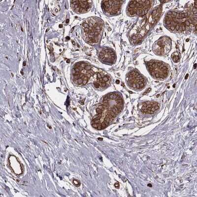 Immunohistochemistry-Paraffin: PALMD Antibody [NBP2-55156]