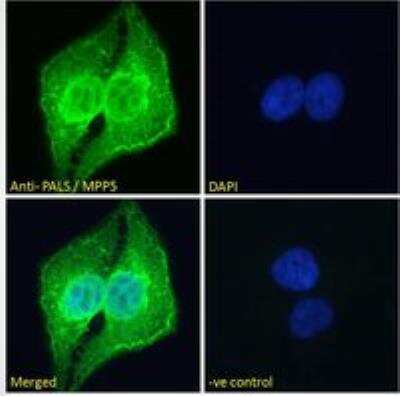 Immunocytochemistry/ Immunofluorescence: PALS1/MPP5 Antibody [NB300-952]