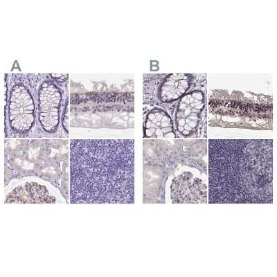 Immunohistochemistry-Paraffin: PALS1/MPP5 Antibody [NBP2-68812]