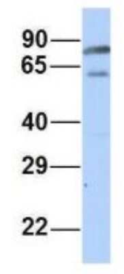 Western Blot: PALS1/MPP5 Antibody [NBP1-54724]