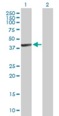 Western Blot: PANK1 Antibody [H00053354-B01P]