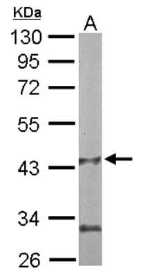 Western Blot: PANK1 Antibody [NBP1-32509]