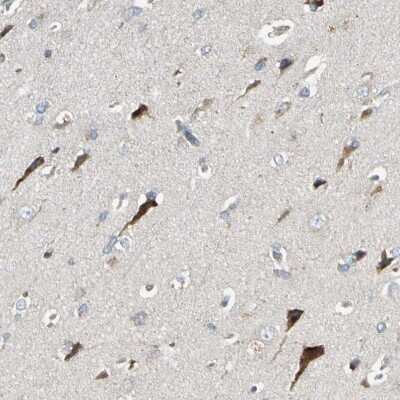 Immunohistochemistry-Paraffin: PANK2 Antibody [NBP1-88295]