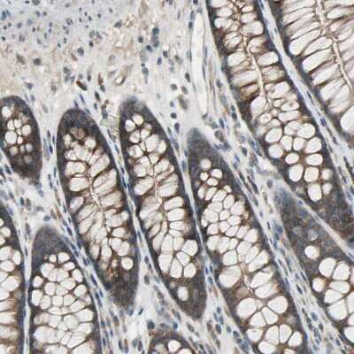 Immunohistochemistry-Paraffin: PANK2 Antibody [NBP1-88295]