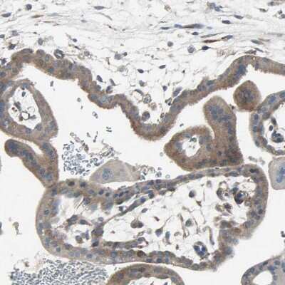 Immunohistochemistry-Paraffin: PANK2 Antibody [NBP1-88295]