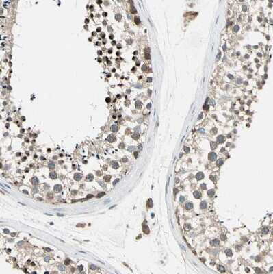 Immunohistochemistry-Paraffin: PANK2 Antibody [NBP1-88295]