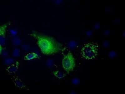 Immunocytochemistry/ Immunofluorescence: PANK2 Antibody (OTI3H9) - Azide and BSA Free [NBP2-73241]