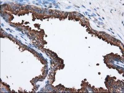 Immunohistochemistry: PANK2 Antibody (OTI3H9) - Azide and BSA Free [NBP2-73241]