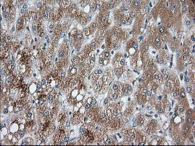 Immunohistochemistry: PANK2 Antibody (OTI3H9) - Azide and BSA Free [NBP2-73241]