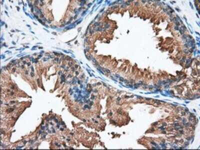 Immunohistochemistry: PANK2 Antibody (OTI3H9) - Azide and BSA Free [NBP2-73241]