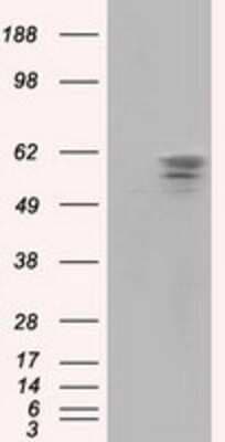 Western Blot: PANK2 Antibody (OTI3H9)Azide and BSA Free [NBP2-73241]