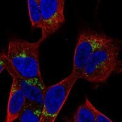 Immunocytochemistry/ Immunofluorescence: PANK3 Antibody [NBP3-17749]