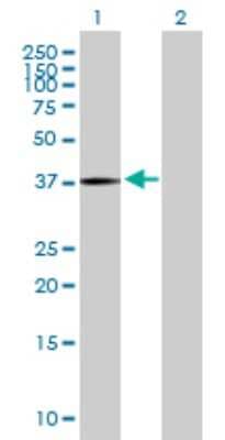 Western Blot: PANK3 Antibody [H00079646-B01P]