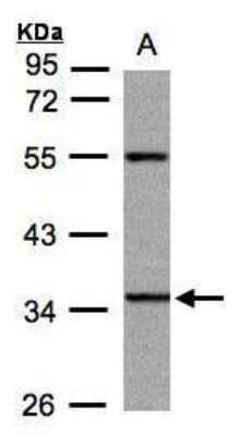 Western Blot: PANK3 Antibody [NBP1-32638]