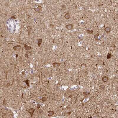 Immunohistochemistry-Paraffin: PANP/PILR alpha associated neural protein Antibody [NBP1-90541]