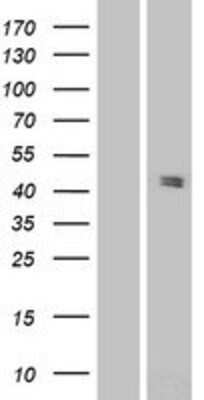 Western Blot: Pannexin-3 Overexpression Lysate [NBP2-05832]