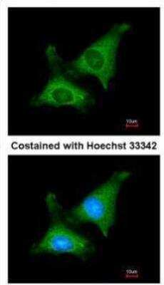 Immunocytochemistry/ Immunofluorescence: PAPD1 Antibody [NBP2-19690]