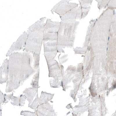Immunohistochemistry-Paraffin: PAPD5 Antibody [NBP2-48777]