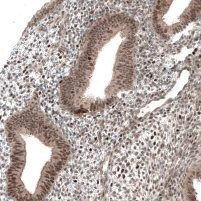 Immunohistochemistry-Paraffin: PAPD5 Antibody [NBP2-48777]