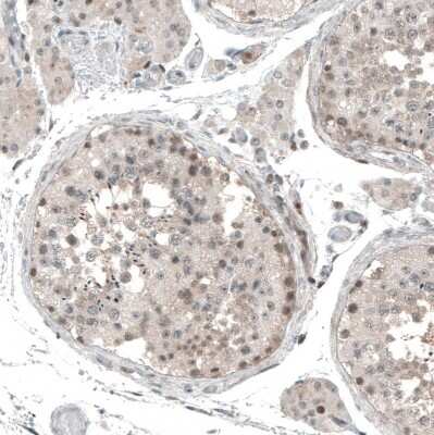 Immunohistochemistry-Paraffin: PAPD5 Antibody [NBP2-48777]
