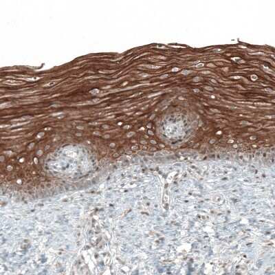 Immunohistochemistry-Paraffin: PAPD5 Antibody [NBP2-48777]