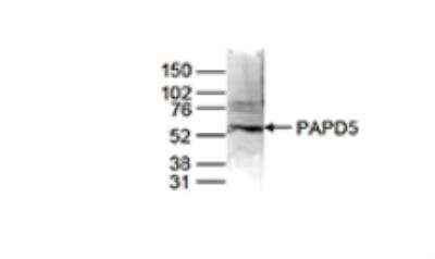 Western Blot: PAPD5 Antibody [NBP2-62796]