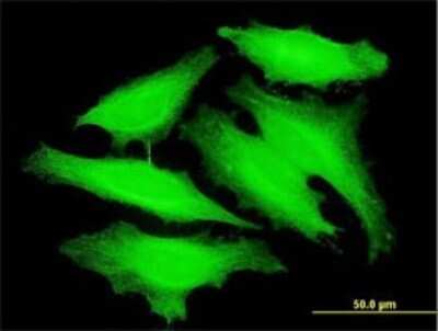 Immunocytochemistry/ Immunofluorescence: PAPOLB Antibody (3D7) [H00056903-M01]