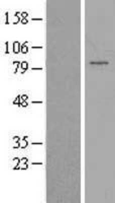 Western Blot: PAPOLG Overexpression Lysate [NBP2-06380]