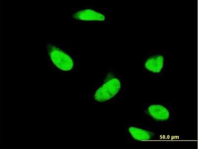 Immunocytochemistry/ Immunofluorescence: PAPSS1 Antibody (1F4) [H00009061-M05]